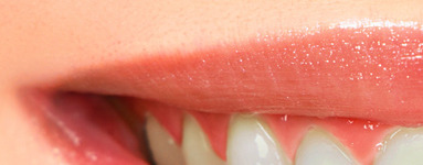 3 naravni načini za beljenje zob